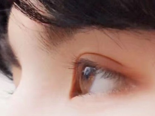 眼角膜发炎是什??症状